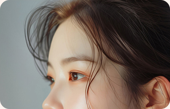 지방이식 후 이마 볼륨 개선
