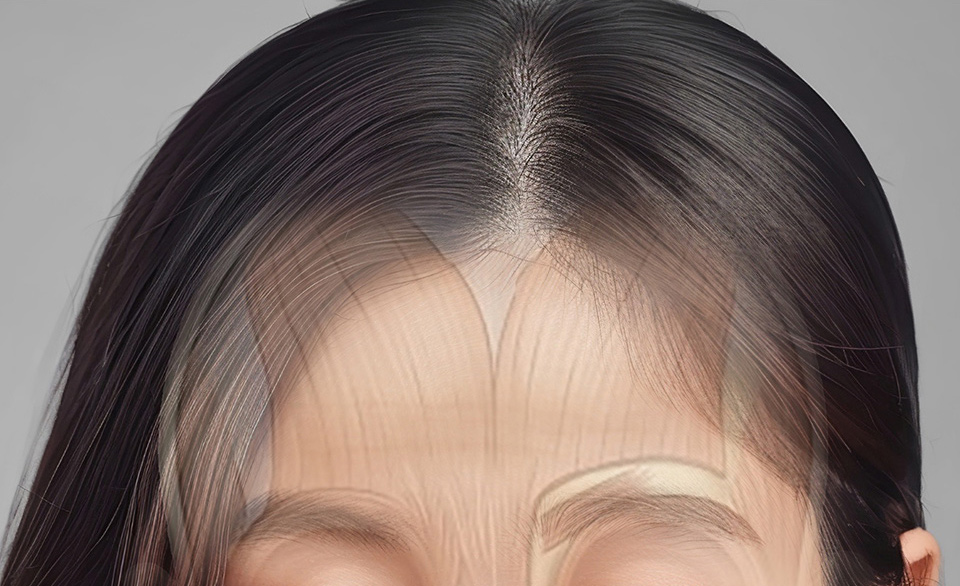 이마거상 체크 포인트