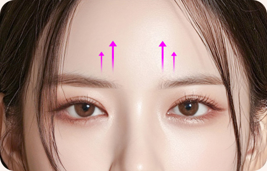 사나운 인상 교정