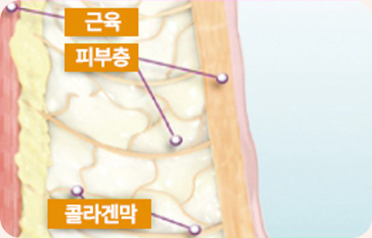 처진부위 분석