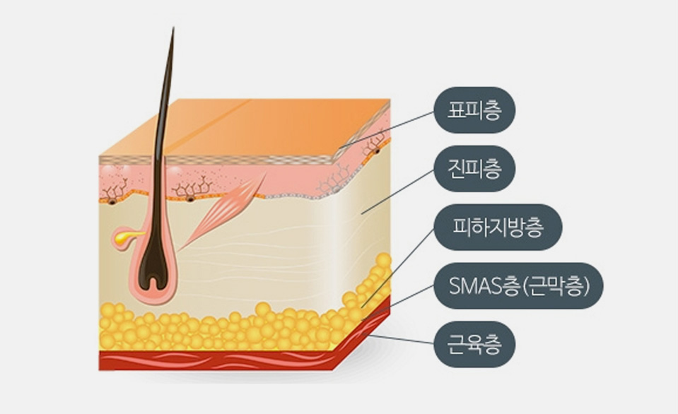 피부층 구조